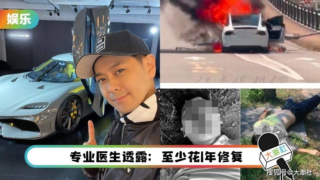 林志颖“颜面骨折”可能需整型<strong></p>
<p>优币网</strong>！网优：不老神颜要陨落了吗