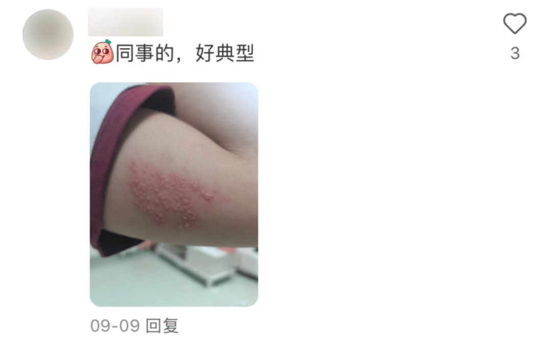 一旦感染终身携带<strong></p>
<p>aaa币行情</strong>！深圳疾控提醒：这4类人要注意
