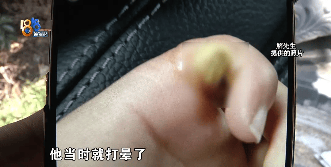 5岁男童瞬间晕厥<strong></p>
<p>td币</strong>，筋都断了！街上常见，看见立即远离