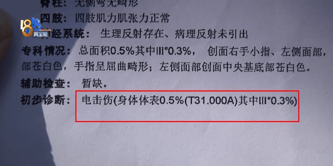 5岁男童瞬间晕厥<strong></p>
<p>td币</strong>，筋都断了！街上常见，看见立即远离