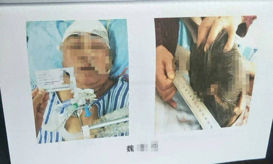 目睹母亲过马路被车撞<strong></p>
<p>祥云币</strong>，27岁女子受惊吓5天后身亡