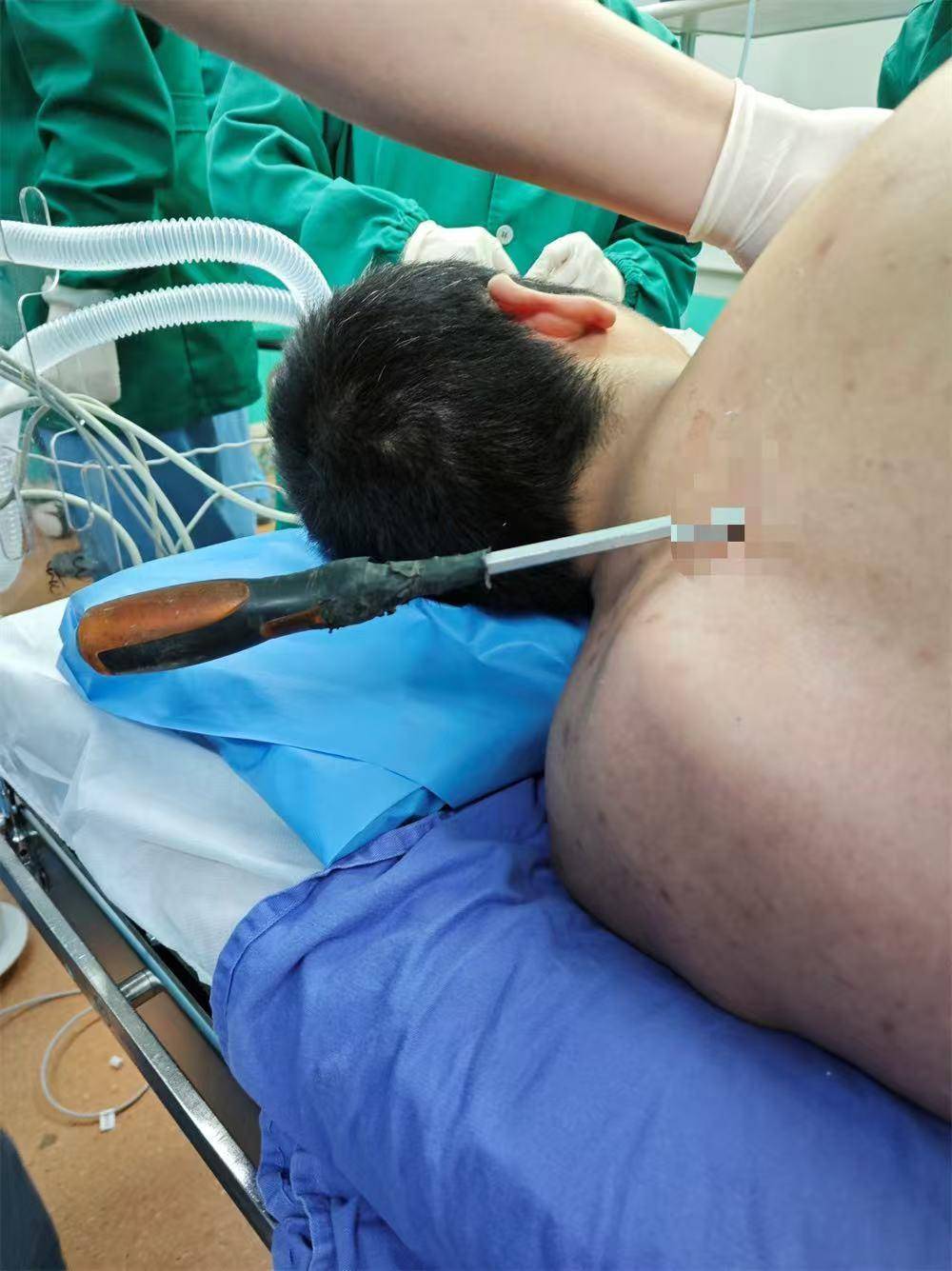 20米高空掉落螺丝刀直插男子胸腔<strong></p>
<p>上币保证金</strong>！医生：不要自行拔除