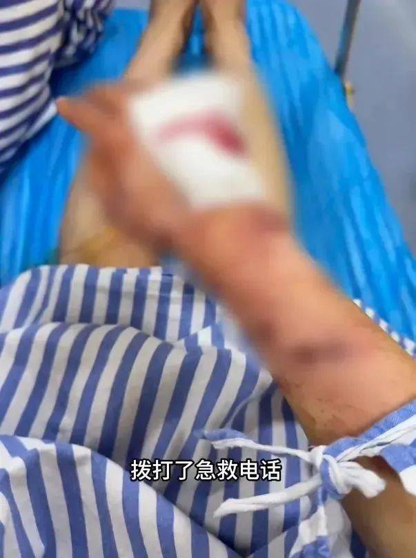 洗澡时突然爆炸<strong></p>
<p>弱打币</strong>，女子手筋断裂，多处缝针……家里有它快自查