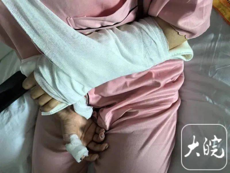 洗澡时突然爆炸<strong></p>
<p>弱打币</strong>，女子手筋断裂，多处缝针……家里有它快自查
