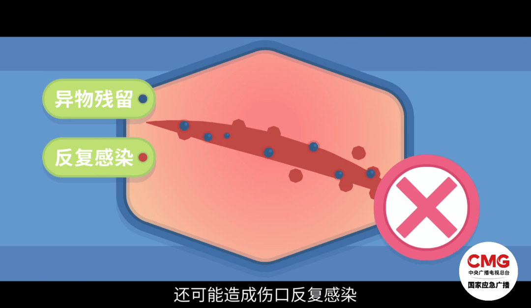 洗澡时突然爆炸<strong></p>
<p>弱打币</strong>，女子手筋断裂，多处缝针……家里有它快自查