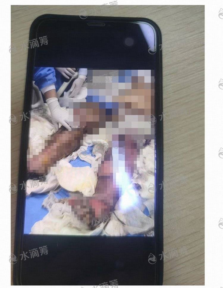 成都一小区电瓶车楼道“飞线充电”酿火灾<strong></p>
<p>炒华克金波段</strong>，一家四口1死2伤，涉事车主被刑拘