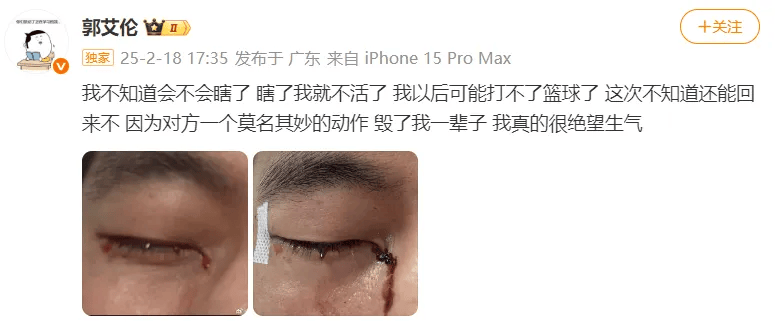 31岁郭艾伦直言想回国家队<strong></p>
<p>沃尔核材股票</strong>，但应该没什么机会了，此前眼睛被队友误伤，缝了40多针