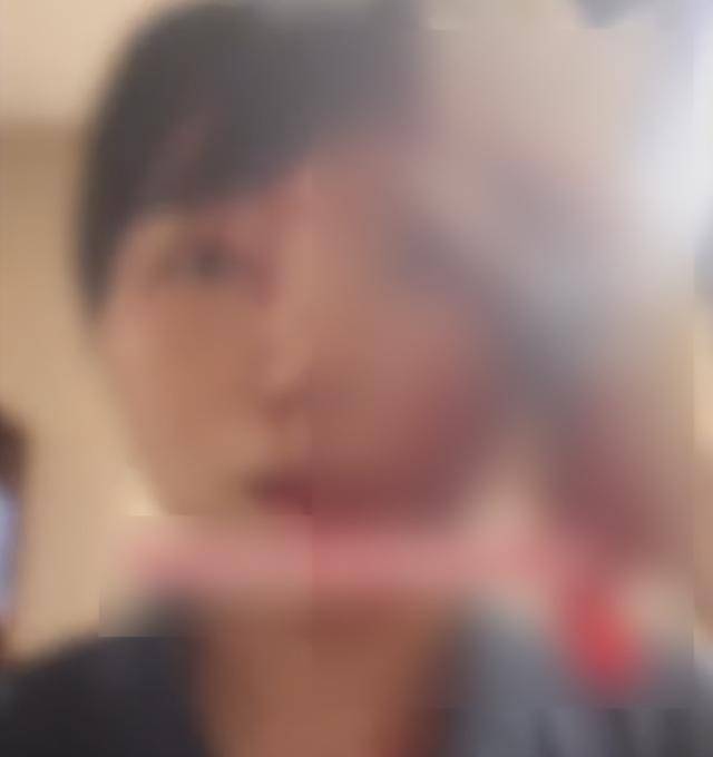 缝了20多针！女子称被不知名男同事砸头毁容<strong></p>
<p>太极实业股票</strong>，警方介入