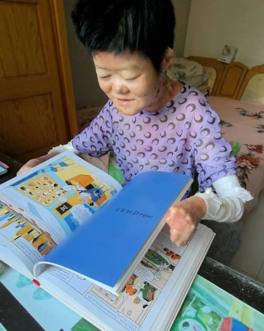医生断言“活不过2岁”的郑州罕见病女孩<strong></p>
<p>可口可乐股票</strong>，24岁“带伤出征”，开启西藏之行