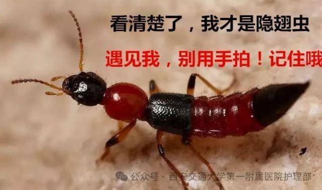 西安多区发现隐翅虫？千万别拍<strong></p>
<p>宝钢股份股票</strong>！毒液堪比硫酸