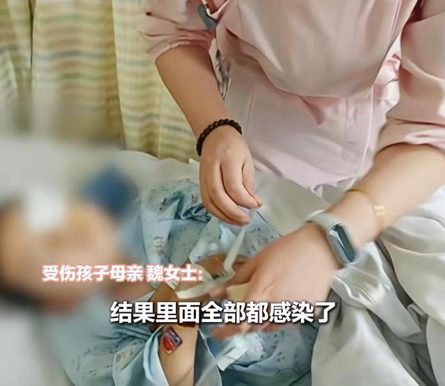 江西一5岁男孩在幼儿园被戳伤致左眼失明<strong></p>
<p>奥普光电股票</strong>，家长称老师用猪油涂抹试图消肿