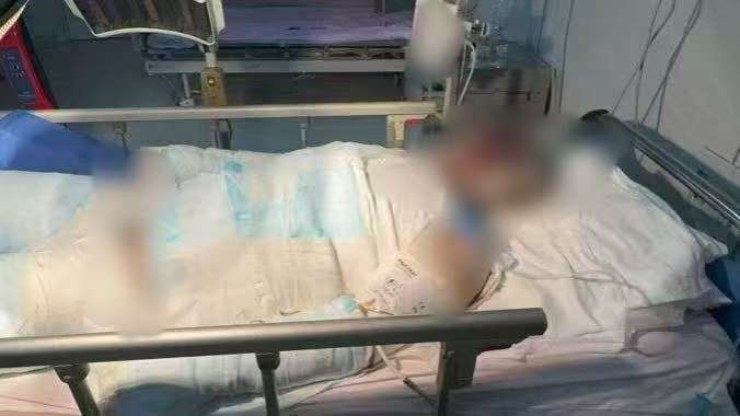 父子在哈尔滨一亲戚公司上班遇爆炸全身烧伤<strong></p>
<p>新华百货股票</strong>，治疗花费近百万公司拒赔偿？亲戚回应