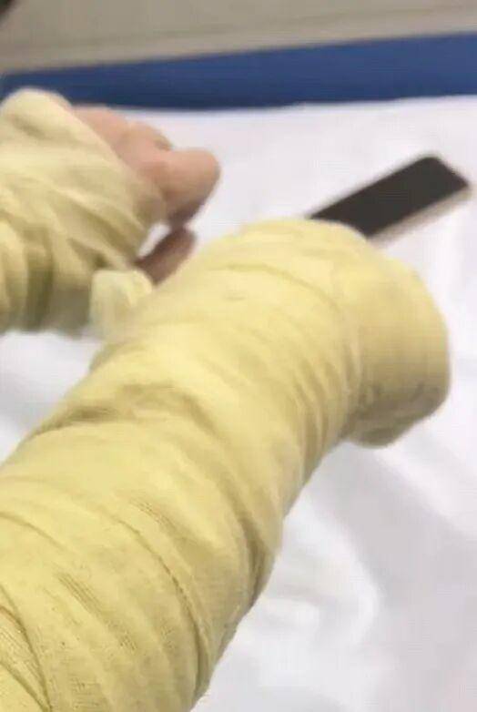湖南一女主播被伪装的包裹炸伤<strong></p>
<p>豪迈科技股票</strong>，永州公安：正在核实具体情况